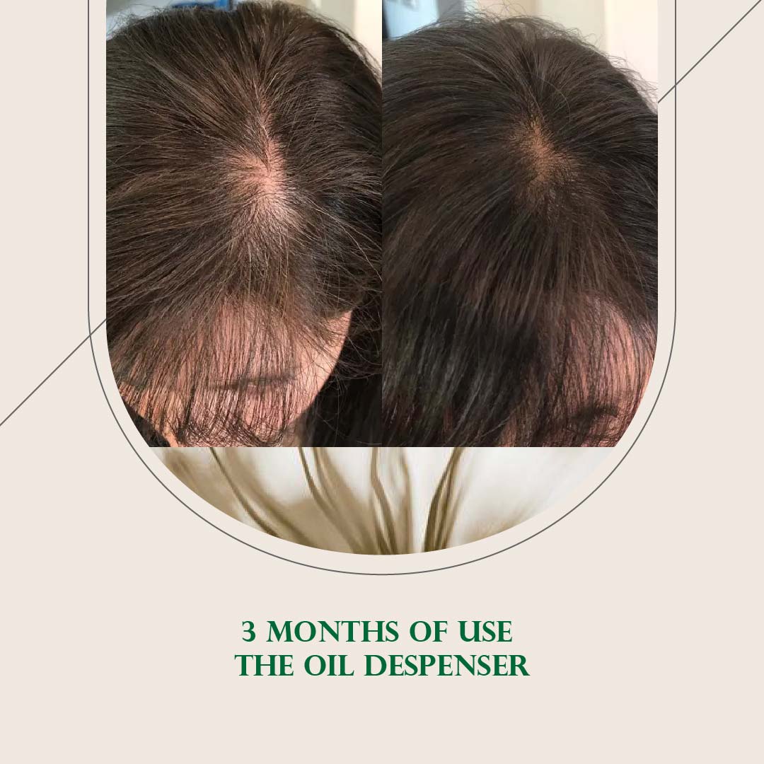 Booster - Hair Growth oil